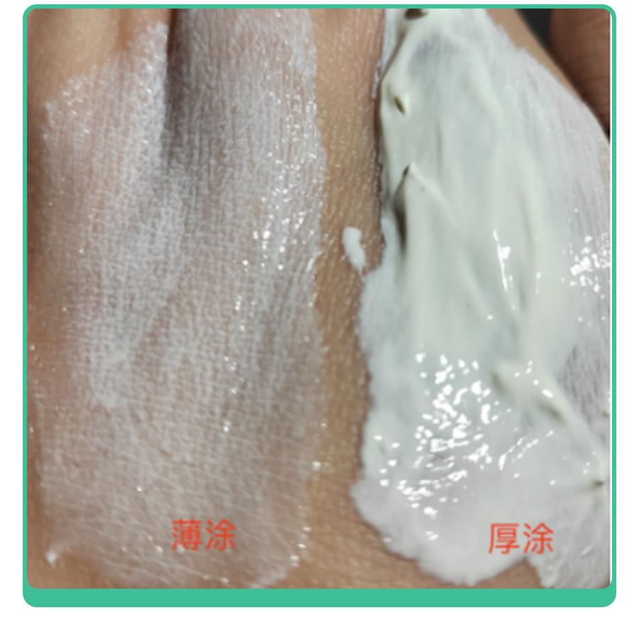 红屁屁擦炉甘石有效吗,儿童蚊虫叮咬皮肤过敏药膏推荐