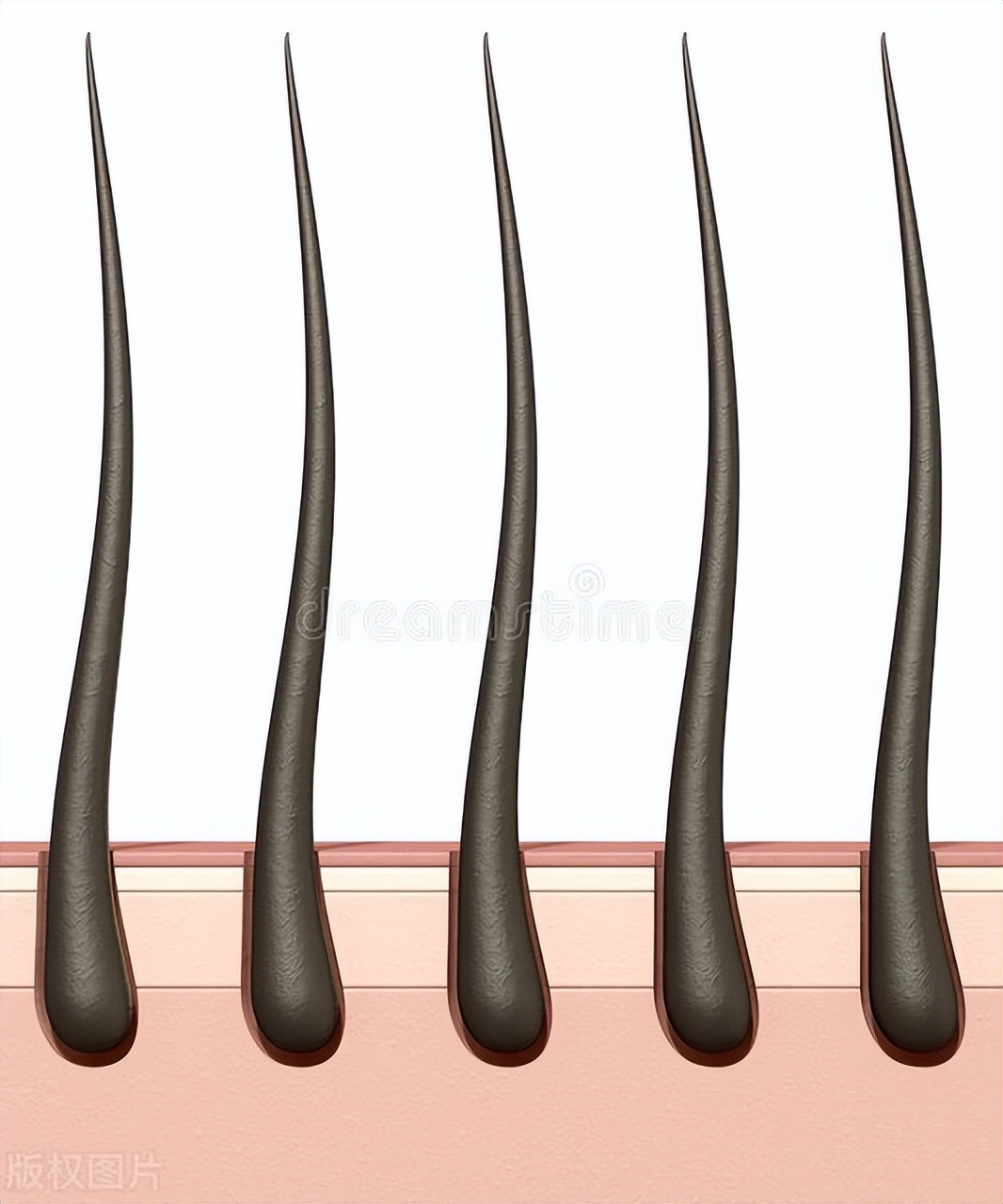 胸部周围为啥长毛毛,女人胸部长汗毛怎么回事