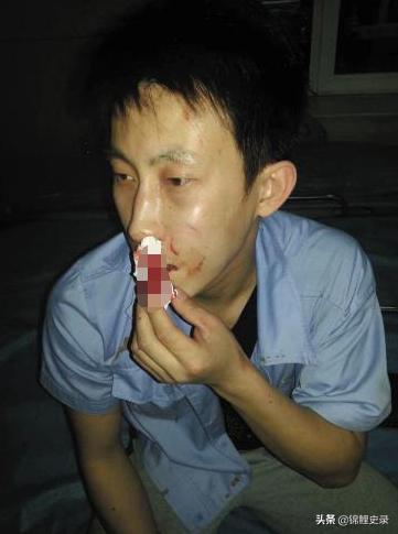 云南男子口臭骇人医生检查惊呼,云南男子口臭传奇故事