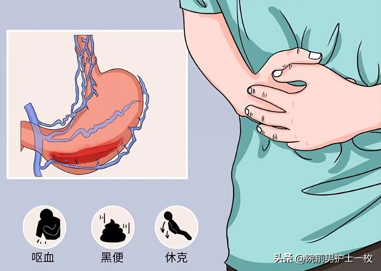 非甾体类消炎止痛药新冠,新冠非甾体类抗炎药