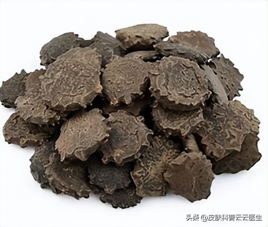 头部的银屑病用什么中药洗,静止期银屑病怎么中药治疗