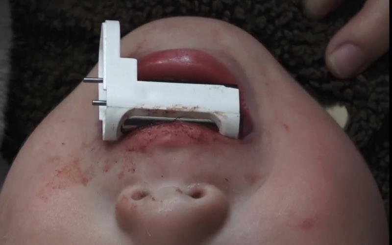 儿童被电动指甲刀卡消防员救援,铁环咬住男童手指消防紧急救援