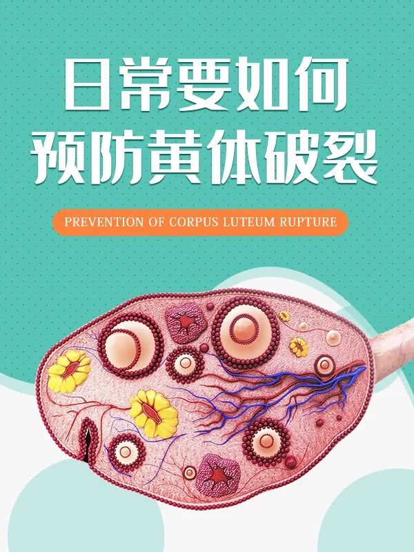 跳毽子操后引发卵巢黄体破裂,跳操会造成卵巢扭转吗