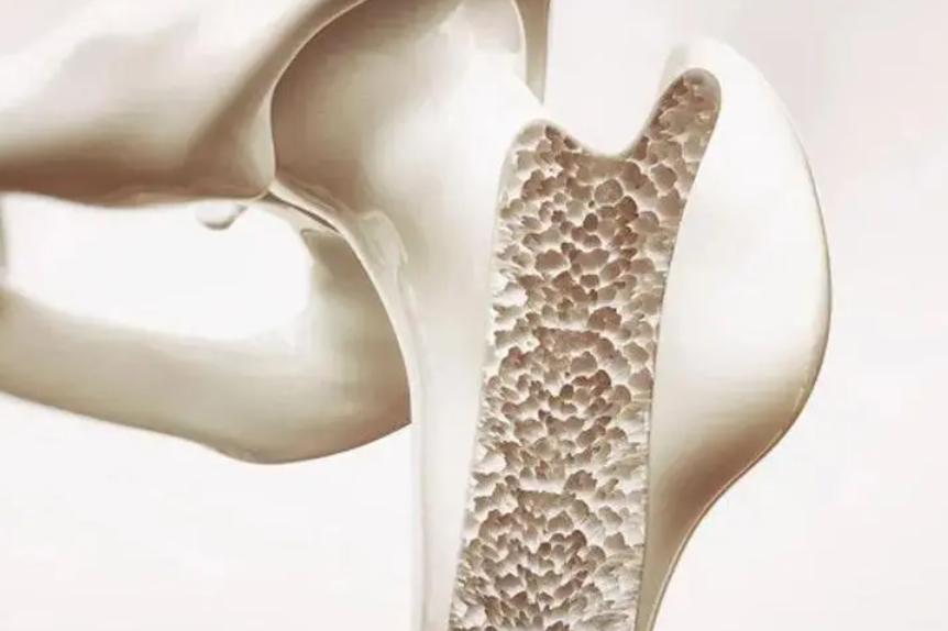 特发性颅内高压，是否会影响肥胖儿童的骨骼发育和身高增长？