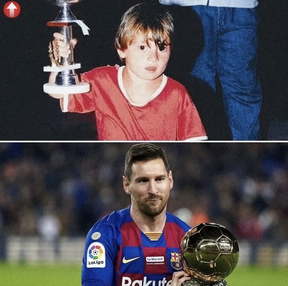 梅西是侏儒症患者吗,梅西身高侏儒症