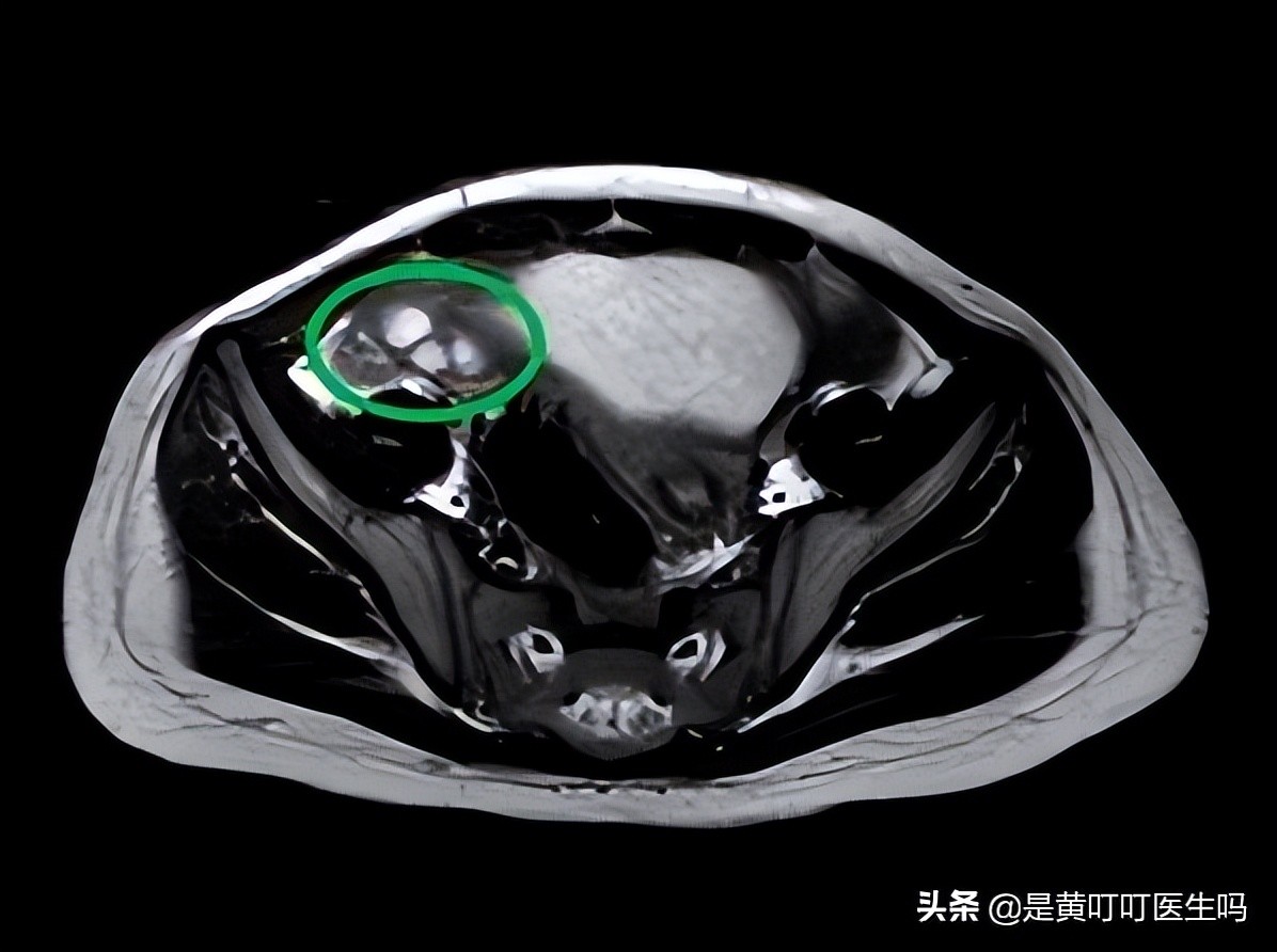 健康科普女生,科普女性健康体检