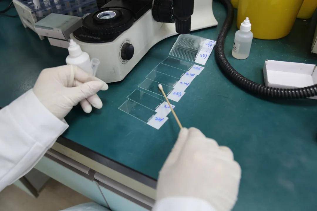 女性来大姨妈建议注意这几件事,每次快要来大姨妈都一股腥臭味