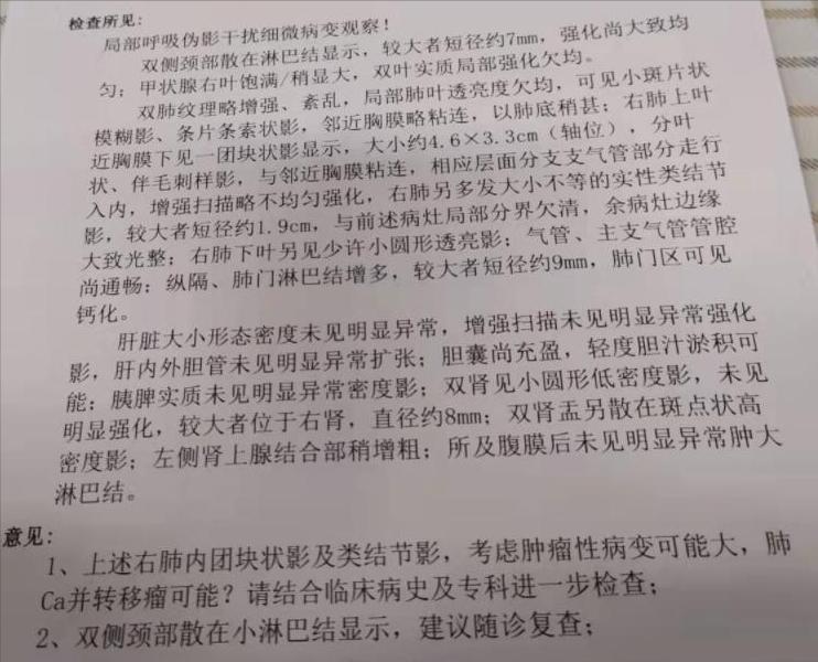肺腺癌从确诊到治疗需要多长时间,一般确诊了早期肺腺癌能活多久