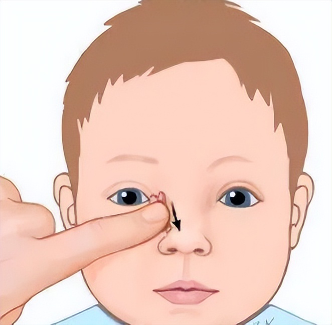 老年人泪道阻塞怎么按摩治疗视频,泪管堵塞中医手法治疗