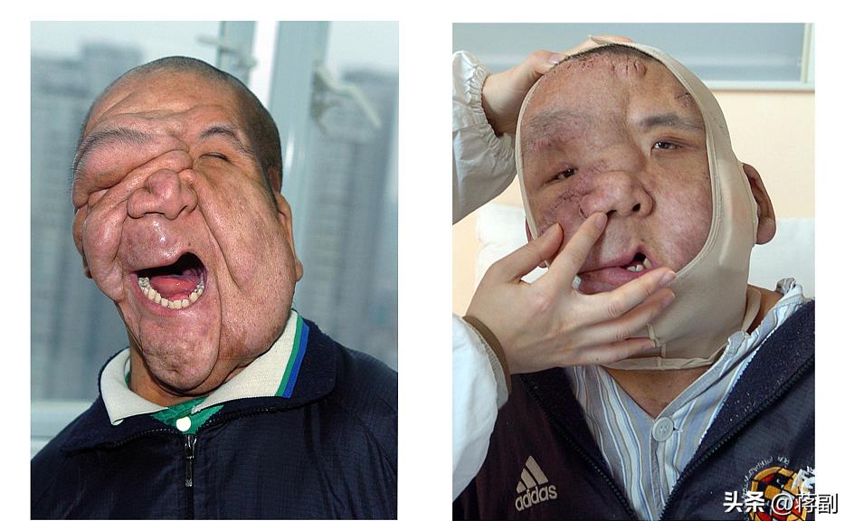 槟榔致癌为什么那么多的人吃,槟榔是明确的致癌物吗