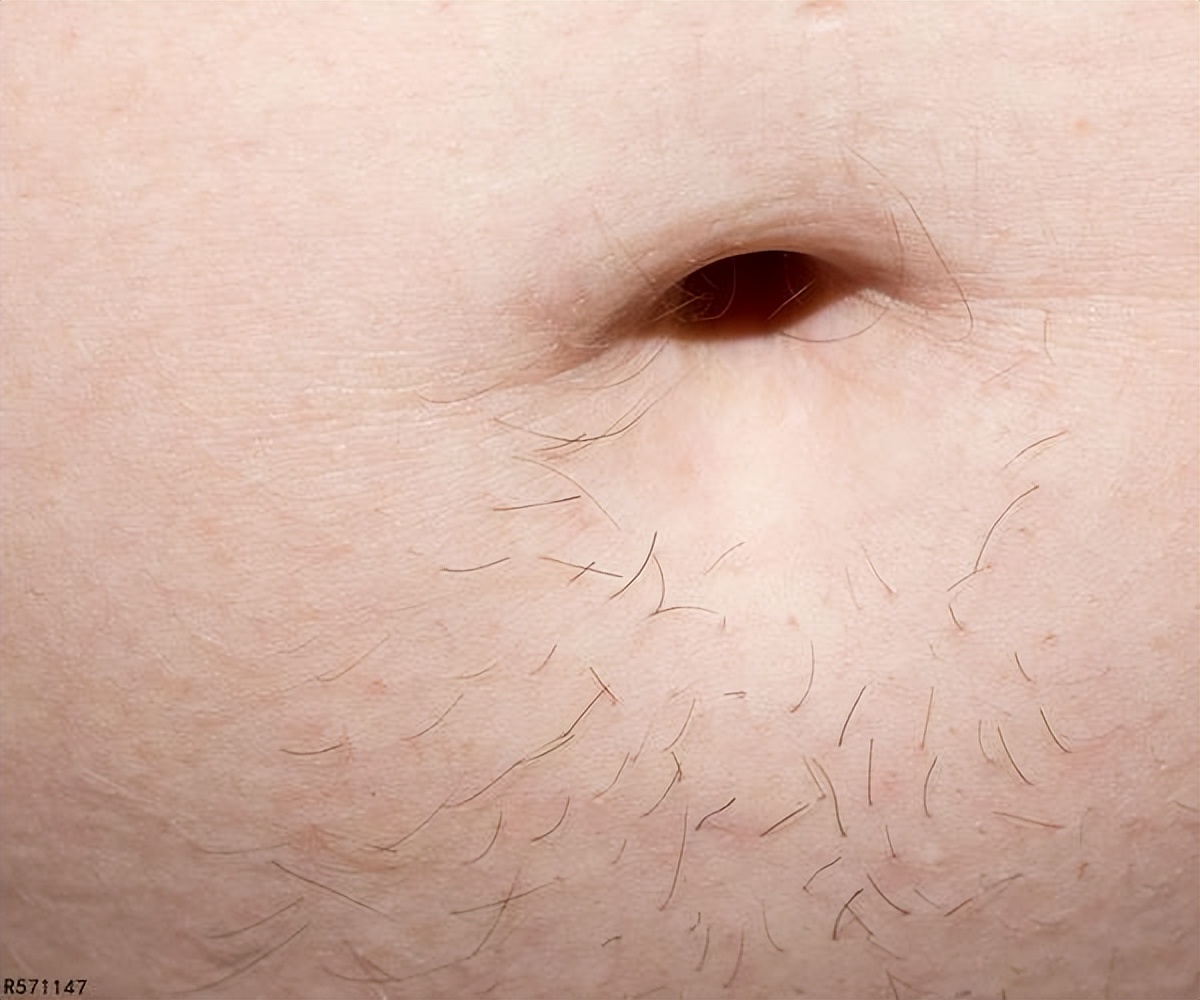 抠肚脐眼的习惯怎么改正,肚脐眼的脏东西抠了肚子疼怎么办