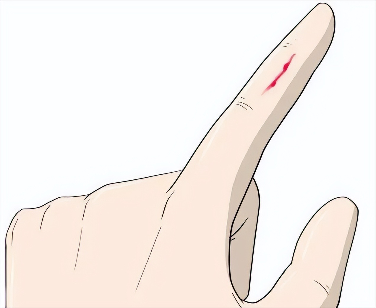 磕到破皮结痂抠掉了怎么办,磕到手肘麻筋破皮流血了