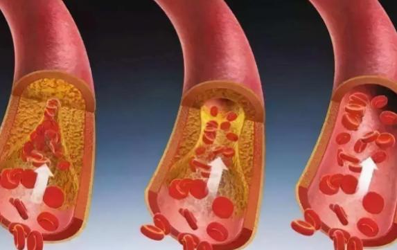 7种香烟被列入黑名单你还在吸吗,这三种香烟最好别碰已列入黑名单