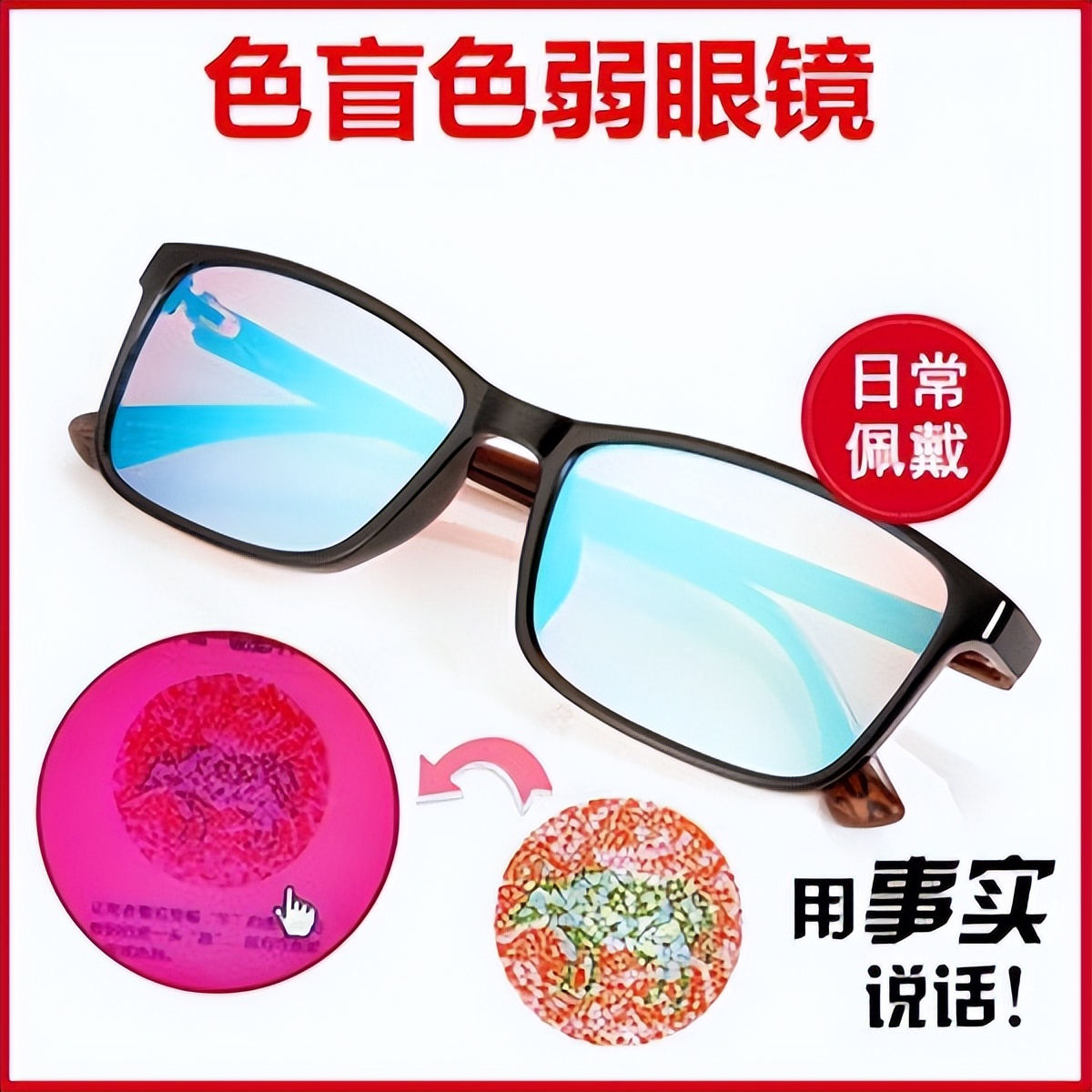 色盲眼睛怎么治疗,色盲是发育缺陷吗