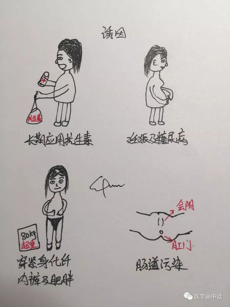 霉菌外阴炎瘙痒用什么药效果好,外阴瘙痒是霉菌炎用什么药最好