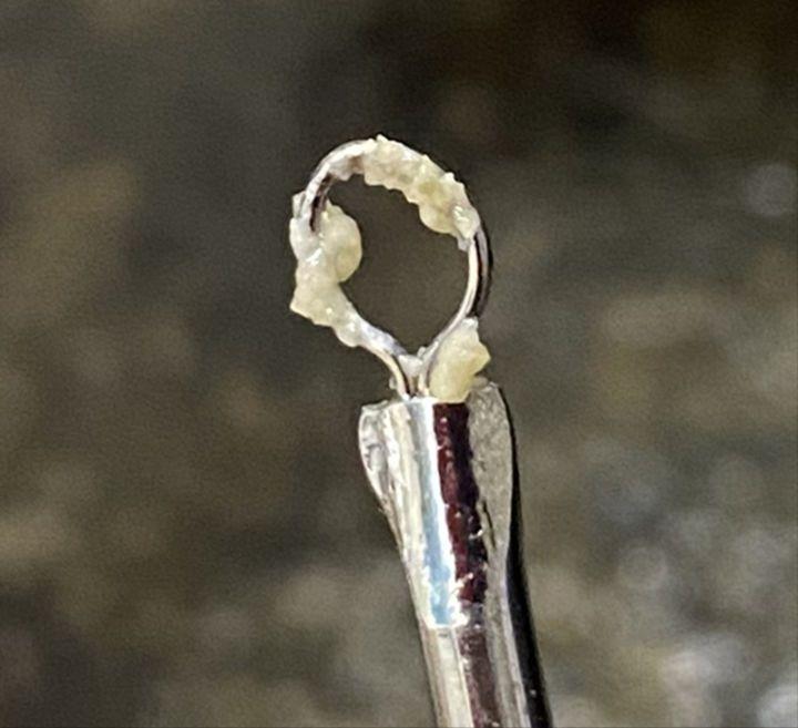 鼻子上有黑点怎么抠掉,鼻子边缘的小白点怎么去除