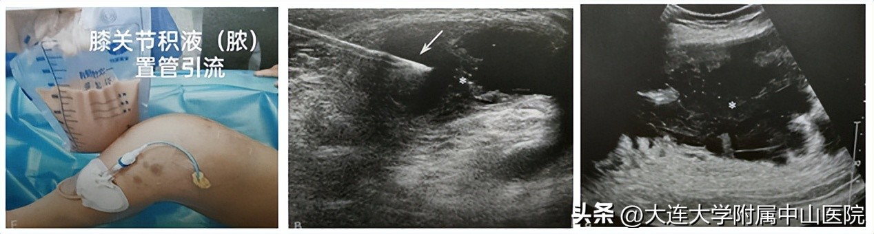 西安肌骨超声精准治疗,门诊超声