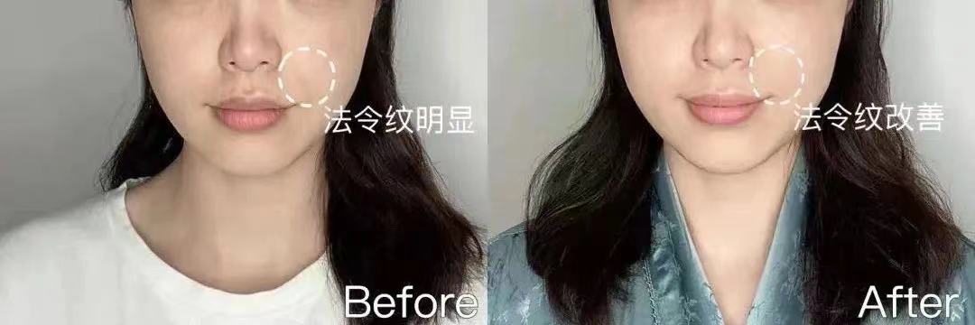 赫莲娜黑绷带面霜为什么那么贵,黑绷带面霜赫莲娜抗皱吗