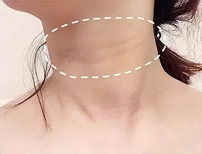 分门别类治皱纹,年轻就是快乐无限