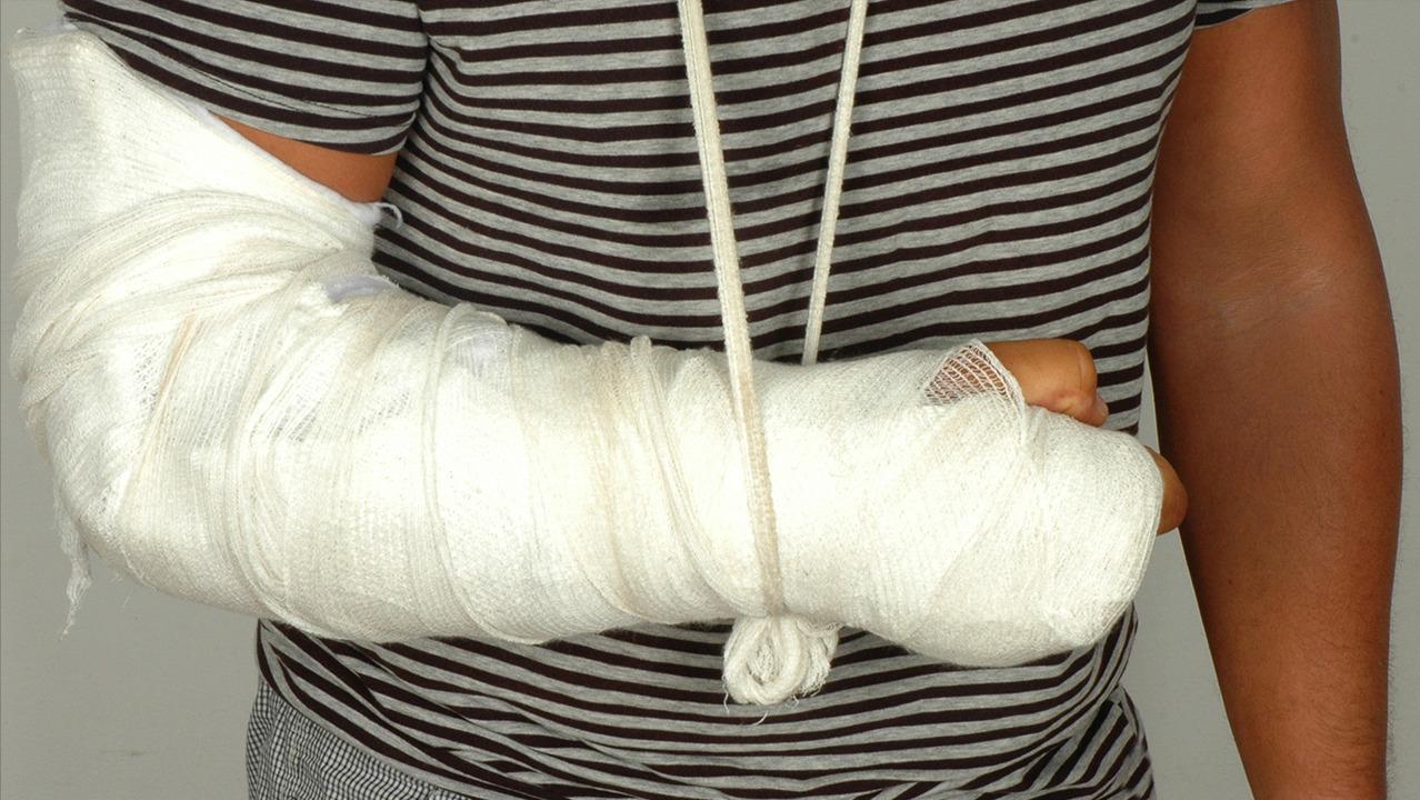 手腕骨折与桡骨远端骨折哪样严重,老年人手桡骨骨折多久能恢复