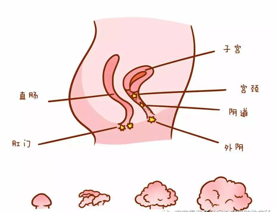HPV病毒阳了之后哪几个型号会长疣？