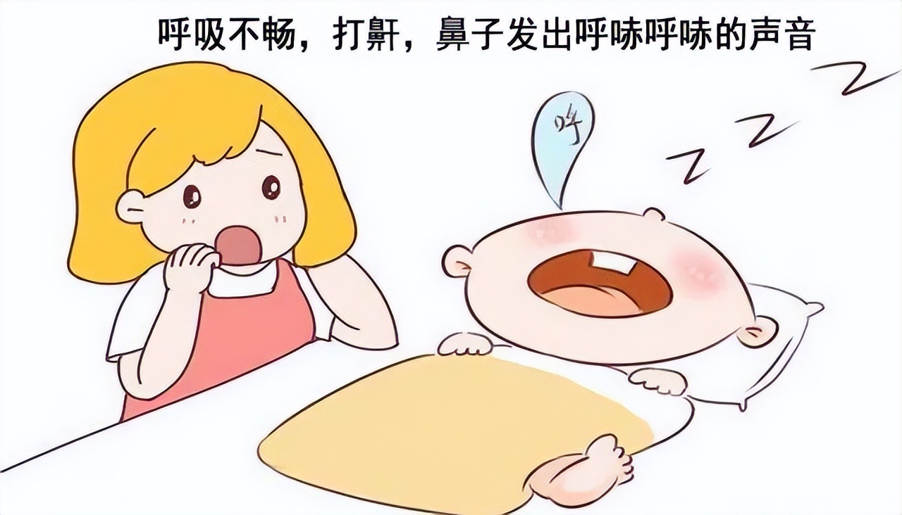 小孩打鼾腺样体肥大怎么保守治疗,小孩老是张嘴呼吸查了腺样体不大