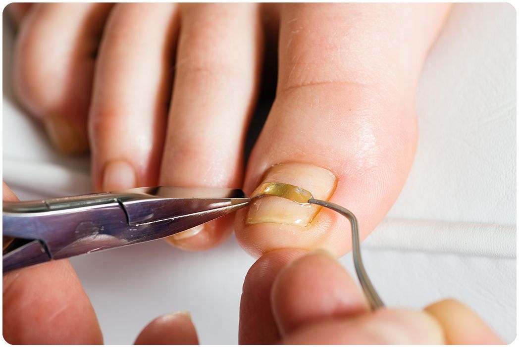 醇鲜然羊大师,怎么剪羊指甲