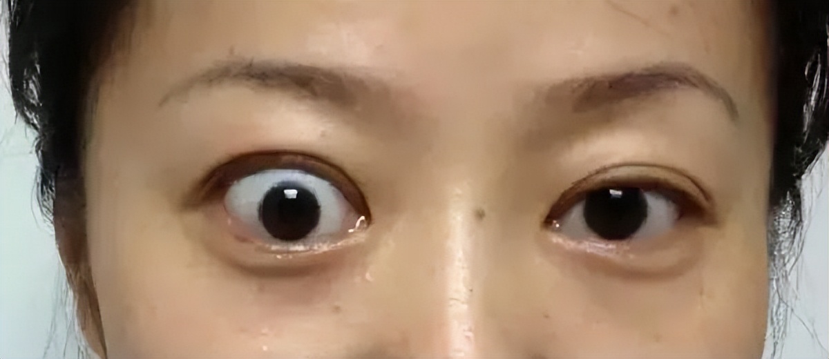 走近中医揭秘健康秘笈,中医甲状腺疾病科普