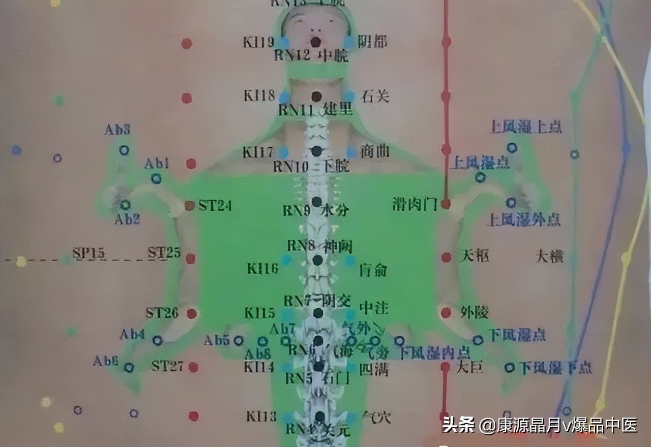 腹针疗法及16例常用处方