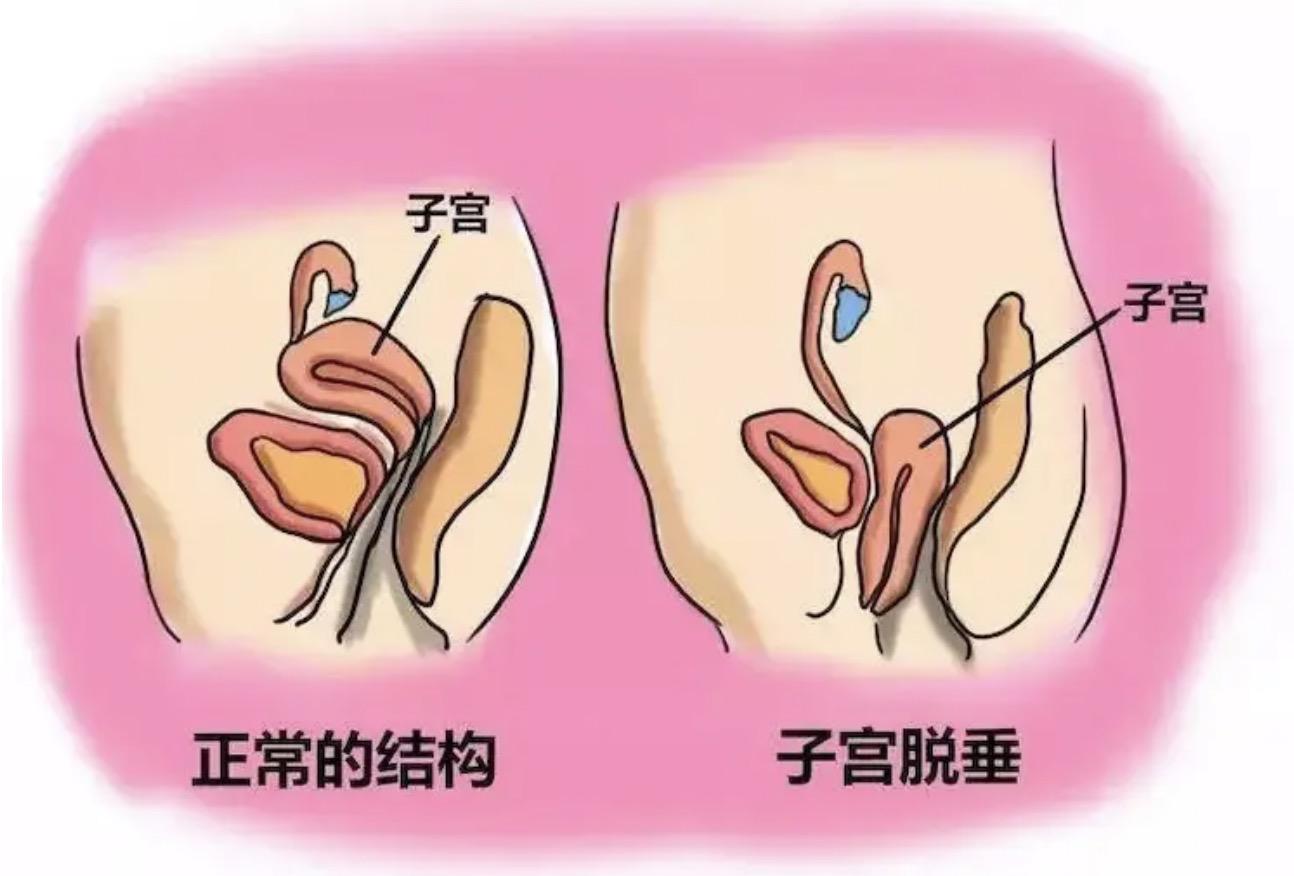 痛苦的疾病治疗,几种不需要治疗的妇科疾病