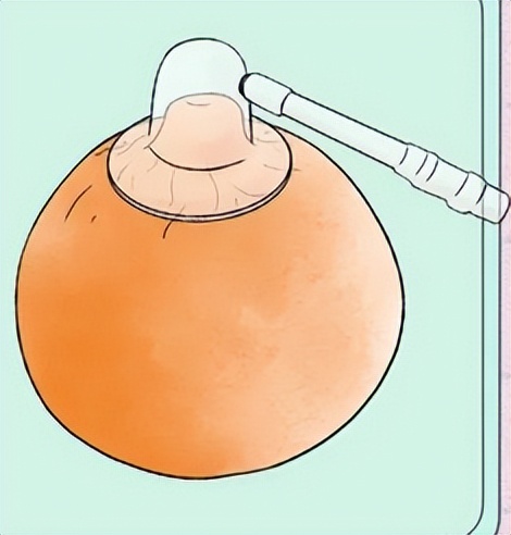 胸部长的褐色小点是什么,女生胸部上长了白色小点点