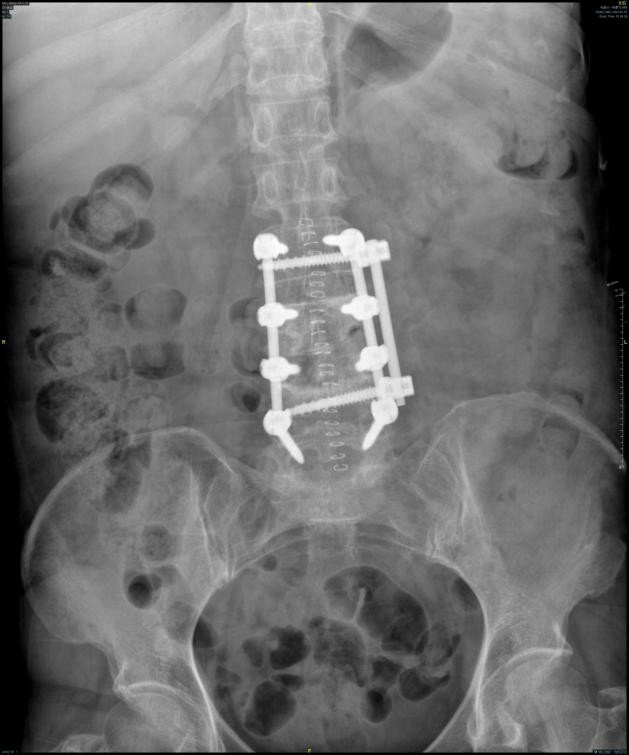 哈尔滨市群力医大一院赵伟,哈尔滨医大一院群力医院赵伟