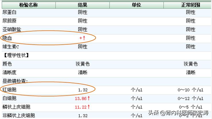 如何解读医学检验单之尿常规,尿常规检验报告单解读