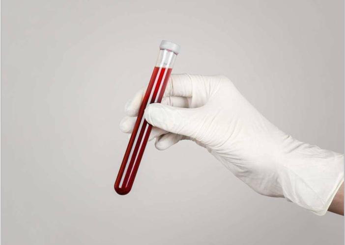 血脂高就不能吃肉,血脂高就不能吃甜食吗