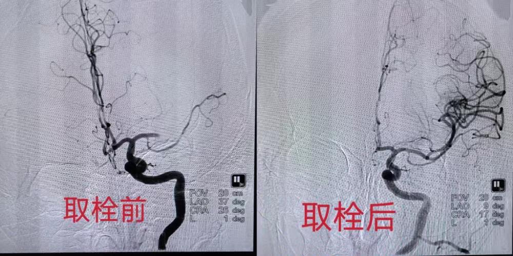 菏泽人民医院抢救,菏泽市医院抢救