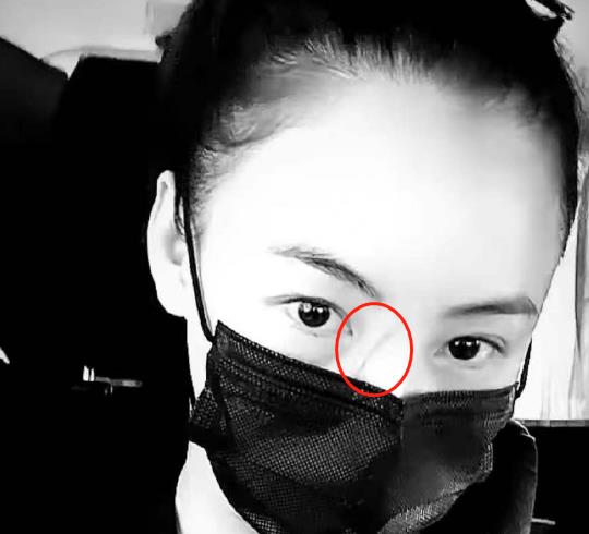 张柏芝手臂伤疤被曝照片,张柏芝被自家宠物狗咬伤视频