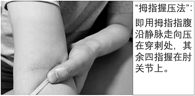 动脉抽血后整条血管发青,胳膊抽血的地方青了一片怎么缓解