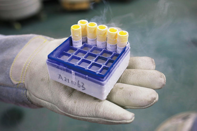 精子库人工授精纳入医保,弱精子症生育保险