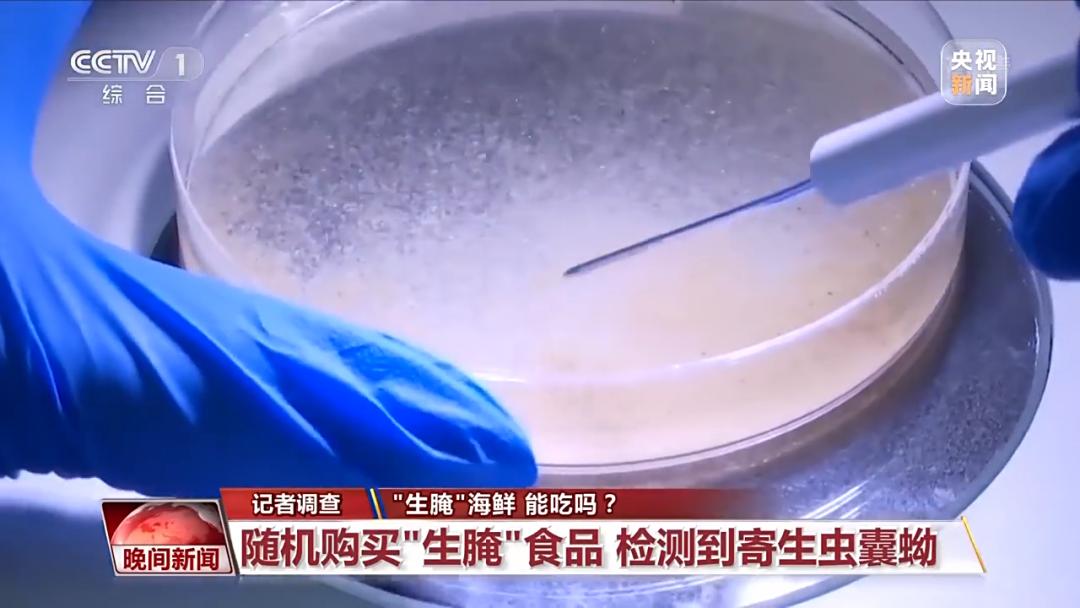吃生腌海鲜寄生虫进入心脏,吃生腌海鲜感染寄生虫会有啥反应