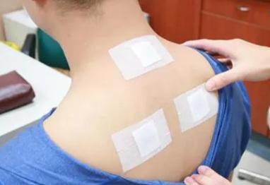 流行性腮腺炎的贴敷疗法