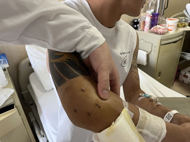 14岁男孩打篮球摔成残原因,小伙打篮球脚踝脱臼复位