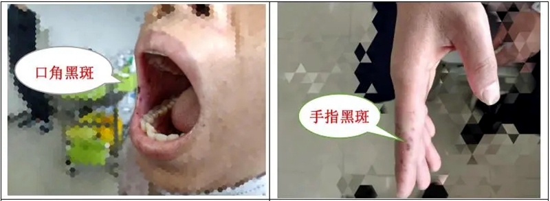 多学科联合诊疗去除顽疾,多学科联合治疗方式