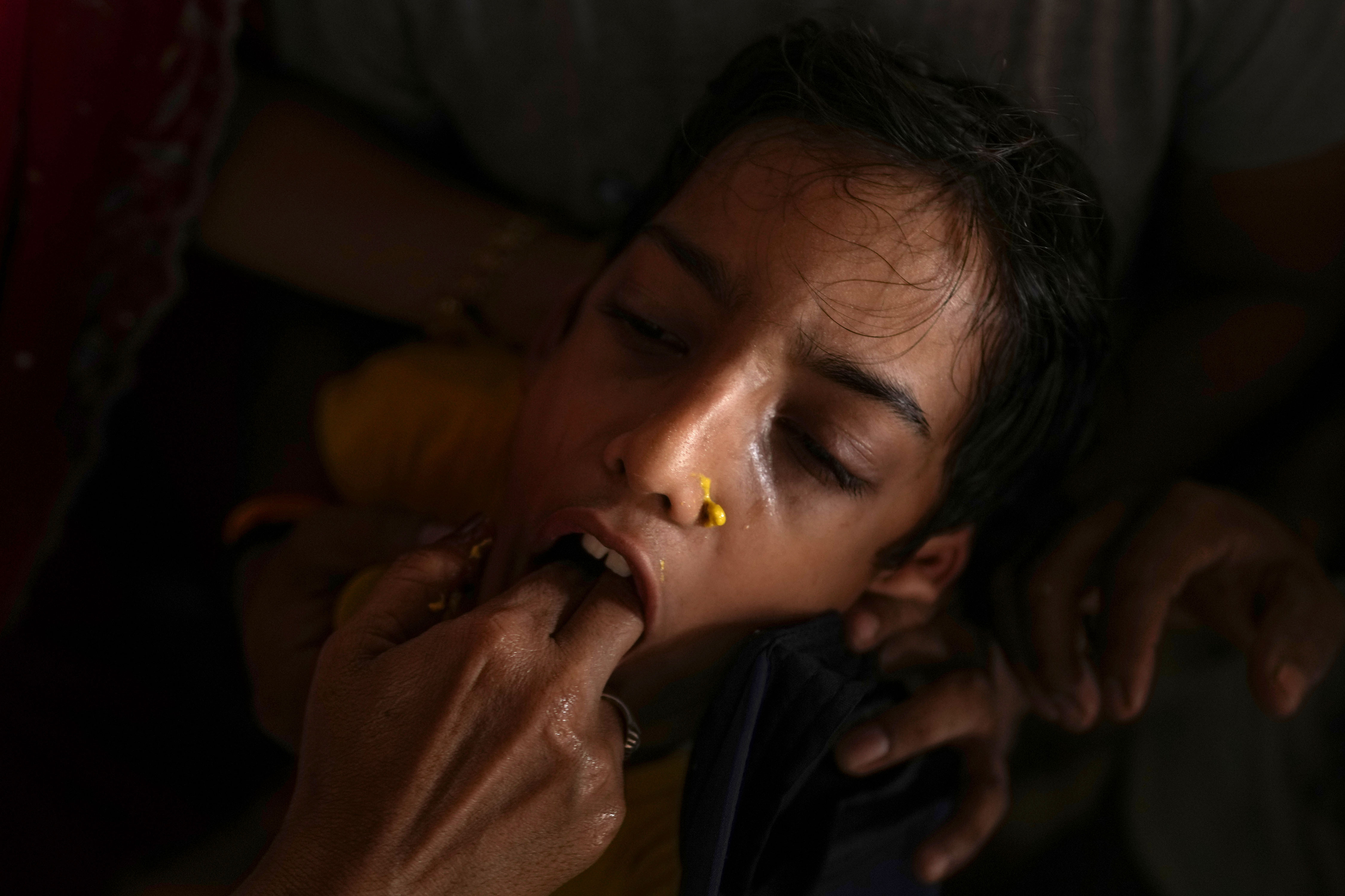 （外代一线）印度：“鱼药”治哮喘