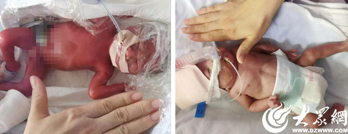 胜利油田医院最新消息,胜利油田中心医院住院