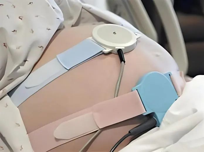 孕妇突发大出血医护人员“生死时速”成功挽救生命